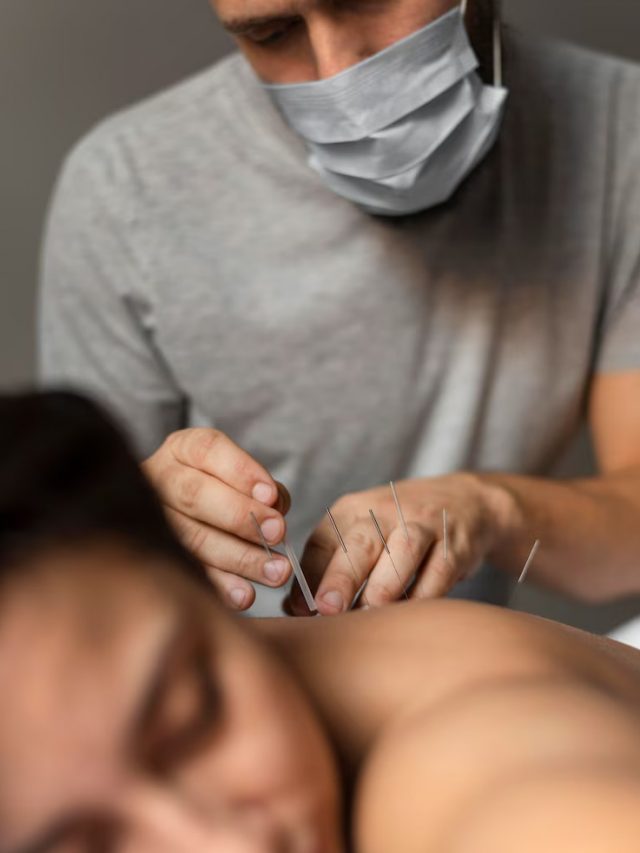 terapeuta-de-close-up-fazendo-acupuntura_23-2148815317